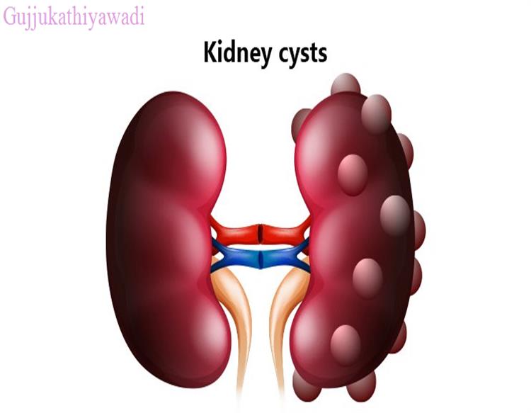 કિડનીની બીમારીના આ 12 લક્ષણો અને નેચરલ ઉપાય.