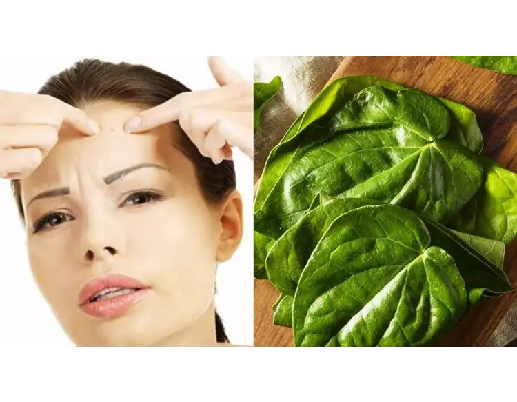 રાતોરાત પિમ્પલ્સથી છૂટકારો મેળવવો છે તો કરો આ કમાલનો ઉપાય