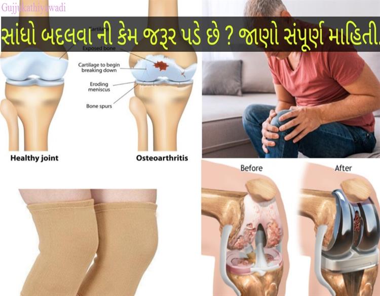 Pectoral Girdle in Gujarati સ્કંધમેખલા