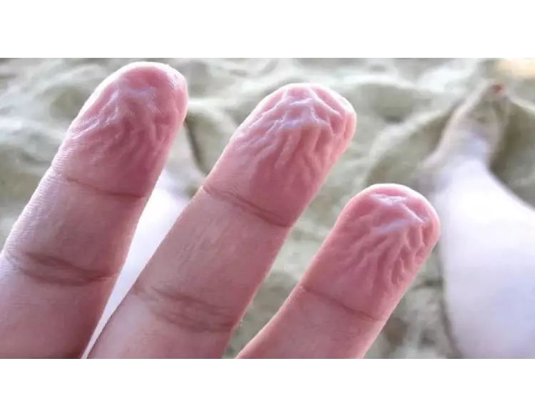 ભીની આંગળીઓ પર આ કારણે થાય છે કરચલીઓ, જાણો રહસ્ય