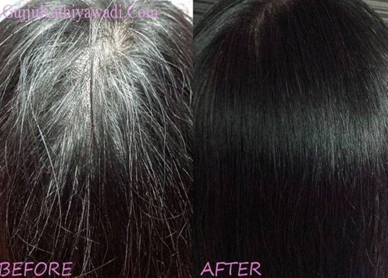 સમય પહેલાં સફેદ વાળની ​​સમસ્યાઓ દૂર કરવામાં આવશે, આ 8 સરળ રસ્તાઓ અપનાવી શકો છો