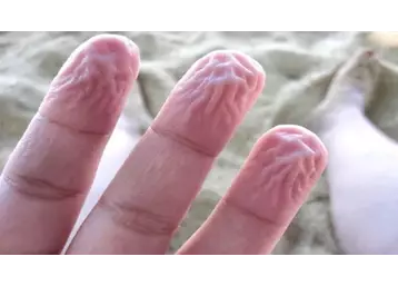 ભીની આંગળીઓ પર આ કારણે થાય છે કરચલીઓ, જાણો રહસ્ય